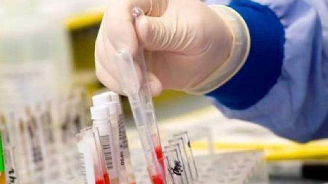 Medicamentele antiretrovirale reduc riscul de transmitere a virusului HIV în cupluri