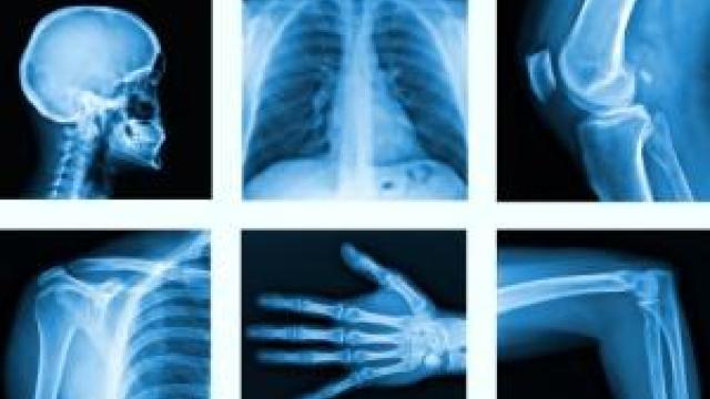 Spitalul Clinic municipal Bălți efectua investigații radiologice neautorizate