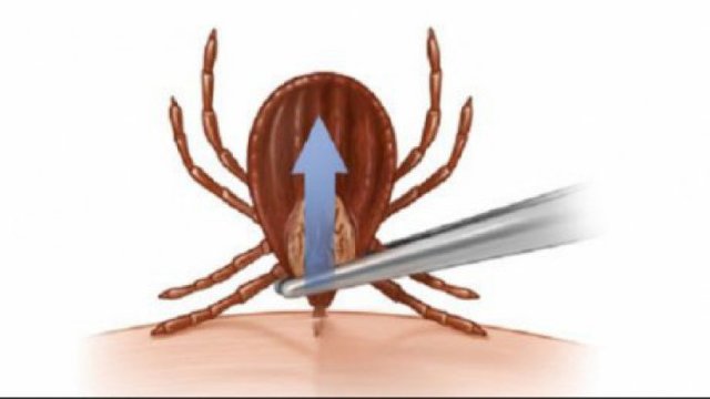 VIDEO | Cum îndepărtezi o căpușă simplu și în siguranță