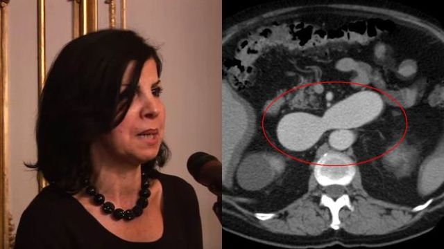 Savanții au reușit să îmbunătățească activitatea cerebrală a unui bărbat care și-a petrecut 15 ani în comă