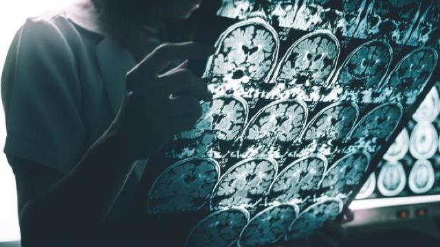 Descoperire uluitoare | Virusul care contribuie la apariția bolii Alzheimer