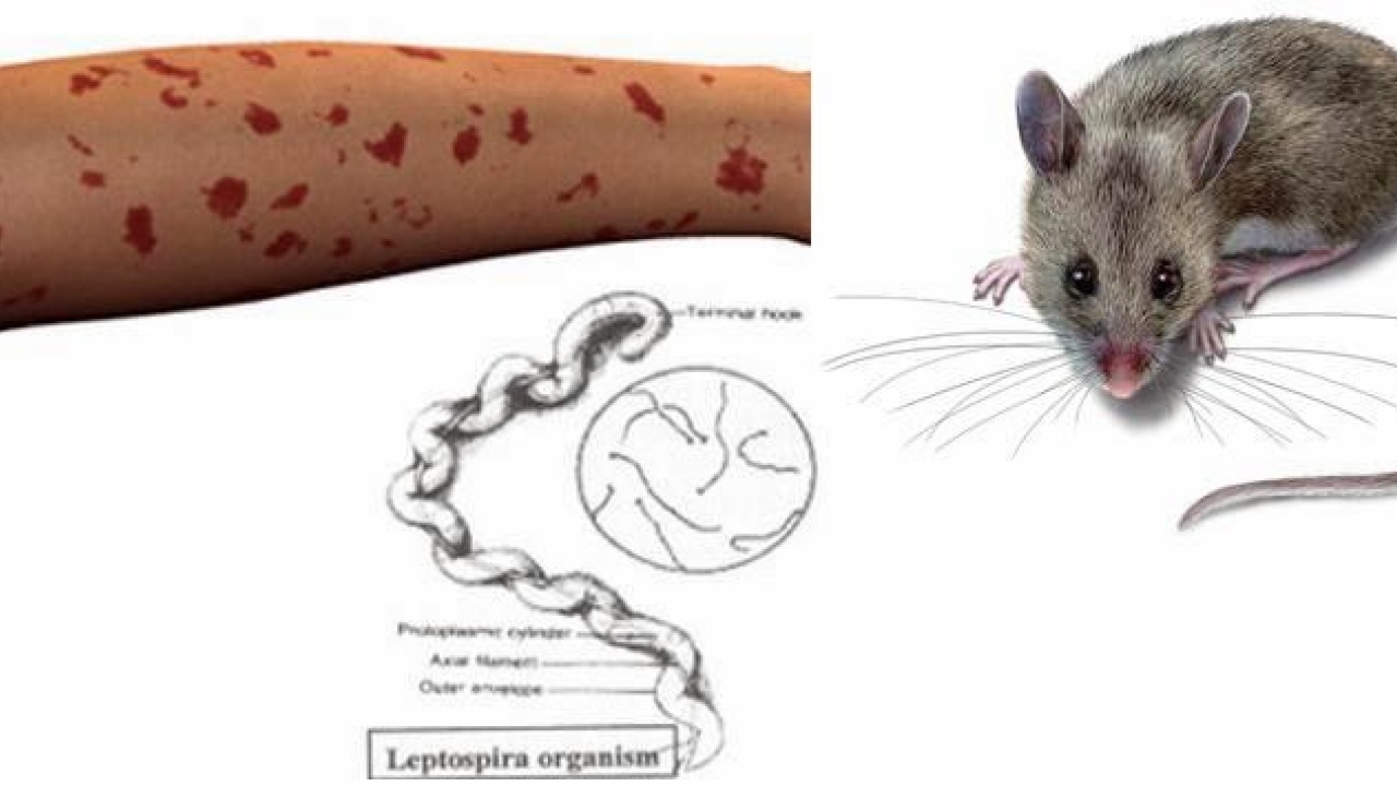Лептоспироз это. Лептоспироз переносчики.