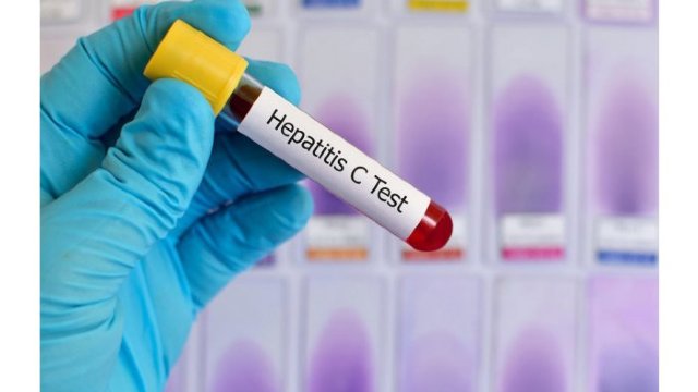 O nouă schemă de tratament a hepatitei B, C și D, a vindecat 96% dintre pacienții beneficiari din R.Moldova
