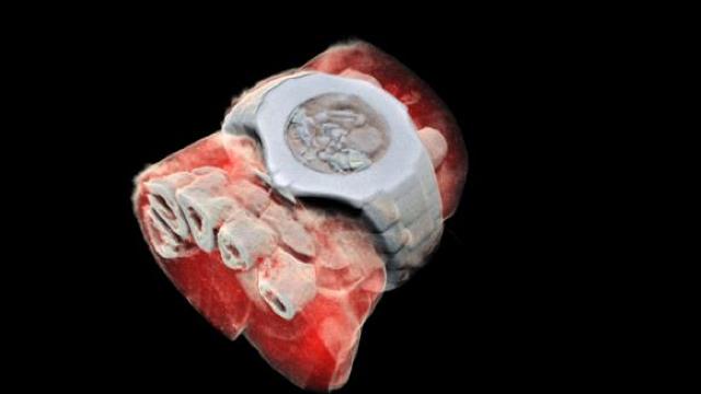 Cercetătorii au realizat prima radiografie 3D în culori a corpului uman