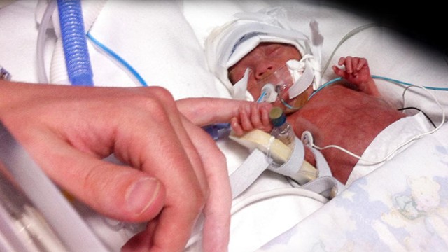 Cel mai mic băiețel din lume, născut la 24 de săptămâni, a ajuns acasă sănătos