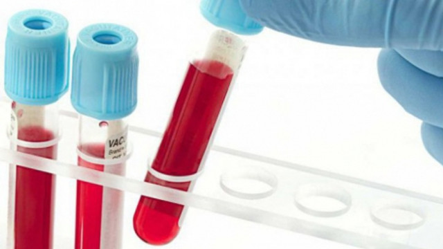 Inovație în medicină | O analiză de sânge, în loc de o investigație chirugicală pentru a detecta cazurile de endometrioză