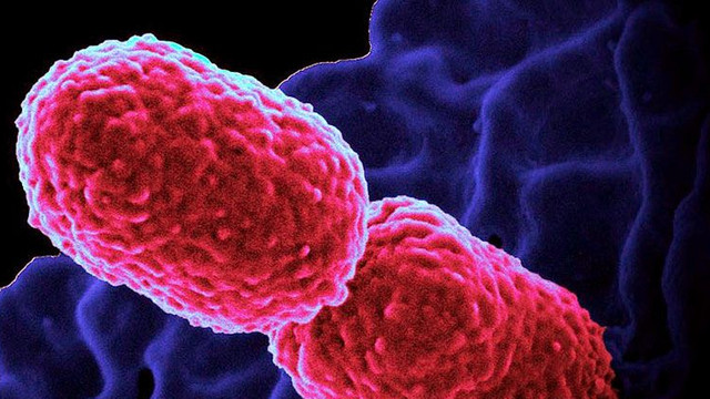 China: Mii de persoane infectate cu o boală bacteriană în urma unei scurgeri de la o fabrică biofarmaceutică
