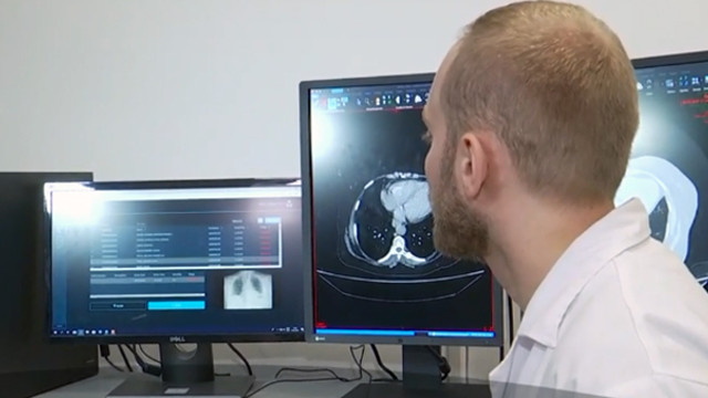 Invenția unui tânăr timișorean | Rezultatele radiografiilor în doar câteva minute, în loc de câteva ore, la Spitalul Județean Timișoara