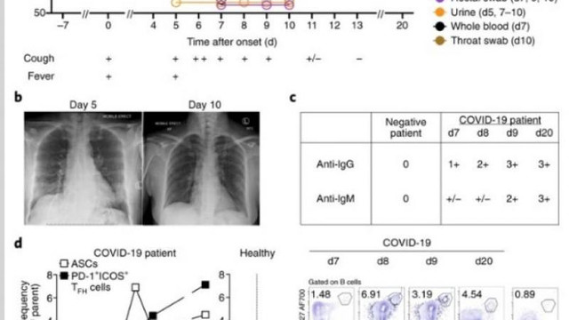Un studiu medical arată modul în care sistemul imunitar contribuie la vindecarea de COVID-19