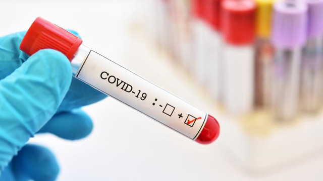 SUA înregistrează, pentru a treia zi consecutiv, un record de noi cazuri de COVID-19