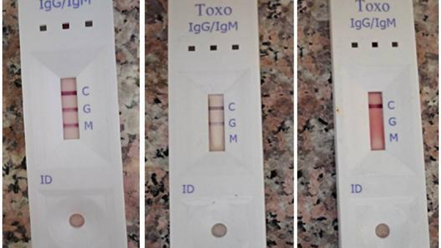 Teste pentru depistarea COVID-19, în farmaciile din R.Moldova. Ce spun medici despre acestea