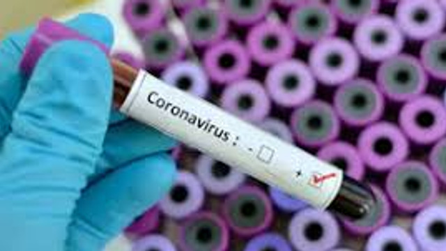 Până în luna mai, în R.Moldova ar putea fi înregistrate aproximativ 31 de mii de cazuri de infectare cu COVID-19