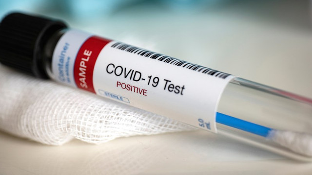 Număr semnificativ de mare de cazuri de infecții și decese provocate de COVID-19, înregistrat în ultimele 24 de ore
