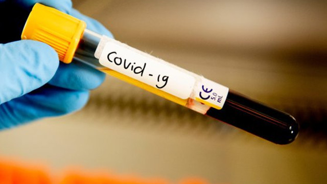 De ce se pierde așa ușor mirosul din cauza COVID-19? Un nou studiu ar putea revoluționa modul de tratare a infecțiilor cu noul coronavirus