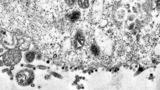 Coronavirus: Cercetători din Florida au descoperit o mutație care sporește capacitatea de infecție a virusului SARS-CoV-2