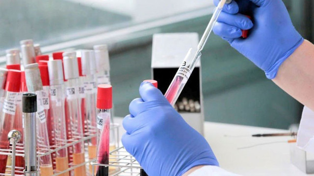 În R.Moldova sunt zece laboratoare care efectuează teste la infecția cu COVID-19