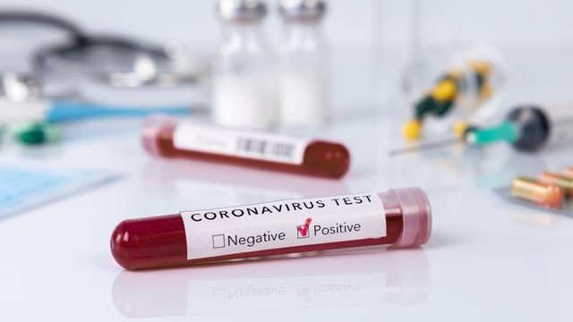 Ministerul Sănătății răspunde dacă sunt cazuri de reinfectare cu COVID-19 în R.Moldova, după ce ministru Pavel Voicu a anunțat că a fost testat din nou pozitiv la coronavirus