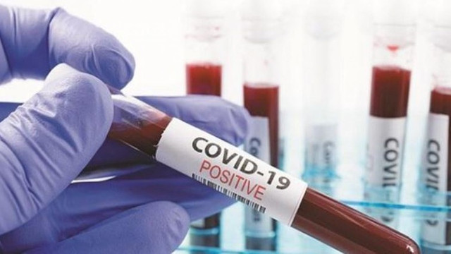 ULTIMA ORĂ | 258 cazuri noi de COVID-19, înregistrate în ultimele 24 ore