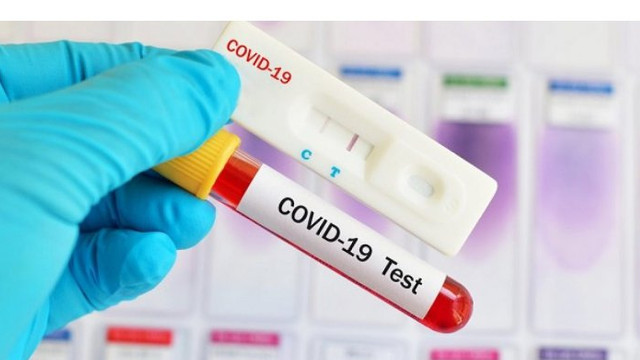 MSMPS va achiziționa încă 100 mii de teste pentru diagnosticarea infecției COVID-19