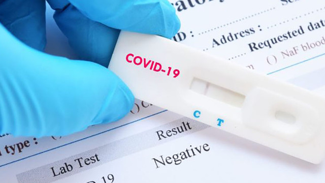 AMDM a înregistrat mai multe tipuri de teste rapide pentru depistarea COVID-19