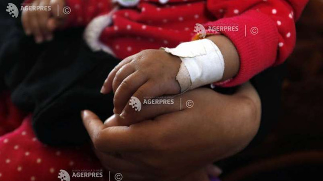 ONU: Jumătate dintre copiii de sub cinci ani din Yemen vor suferi de malnutriție în 2021