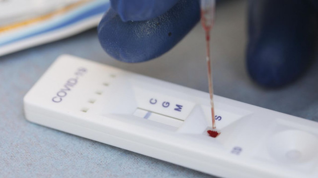 100.000 de teste rapide de detectare a virusului SARSCoV-2 au fost distribuite instituțiilor medicale din R. Moldova. Cine poate beneficia 
