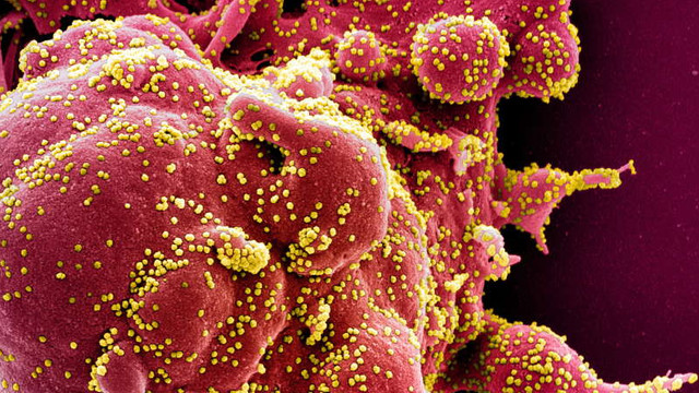 Oamenii de știință au utilizat editarea genetică Crispr pentru blocarea replicării coronavirusului în celule
