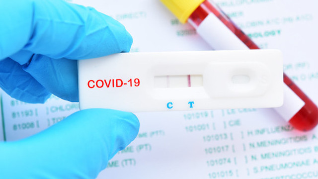 Un deces și alte 89 de cazuri noi de infectare cu COVID-19 au fost confirmate astăzi în Republica Moldova