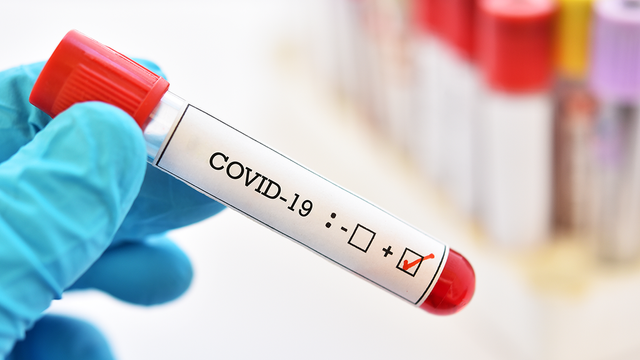 Patru decese și alte 159 de cazuri noi de infectare cu COVID-19, înregistrate în ultimele 24 de ore