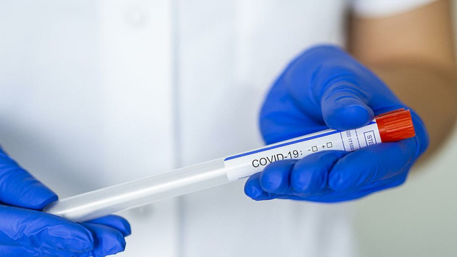 Trei decese și 268 cazuri noi de infectare cu COVID-19, înregistrate în ultimele 24 de ore în R.Moldova