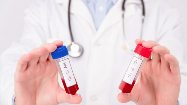 Un vaccin Johnson & Johnson anti-HIV eșuează testul de eficacitate
