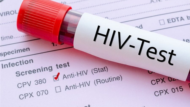 Aproape 15 mii de moldoveni suferă de HIV