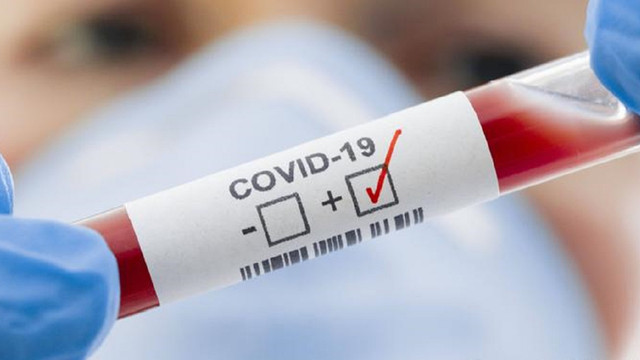 Ministerul Sănătății anunță nouă decese și 279 de cazuri noi de infectare cu COVID-19