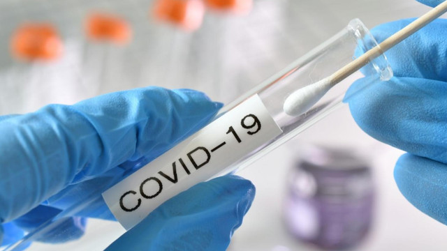 Zece decese și 257 de cazuri noi de COVID-19, raportate pentru 1 aprilie