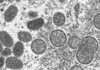 OMS: Nu există dovezi privind mutații ale virusului variolei maimuței. „Este o situație care poate fi ținută sub control”

