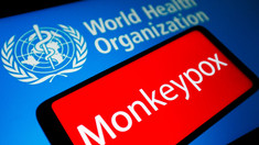 Variola maimuței a fost depistată în 11 țări. Ședință de urgență a OMS, răspândirea pe glob provoacă îngrijorare