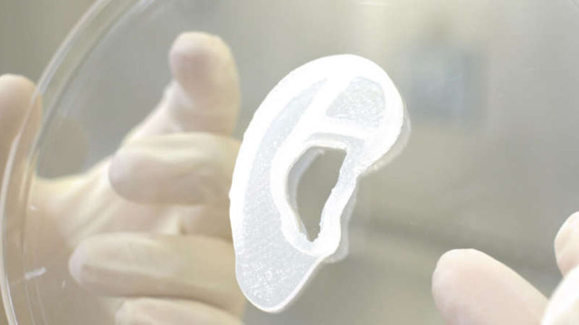 Implant de ureche imprimată 3D pe bază de celule umane, realizat în premieră în Statele Unite