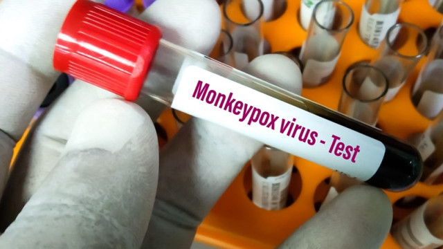 UE cumpără o nouă tranșă de vaccinuri împotriva variolei maimuței
