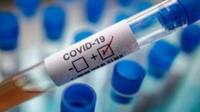 Peste 150 de persoane infectate cu COVID-19 sunt internate în instituțiile medicale din capitală
