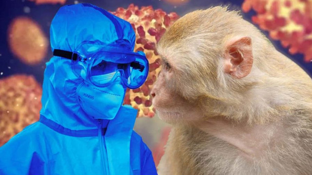Primul deces cauzat de variola maimuței în SUA, confirmat în Los Angeles