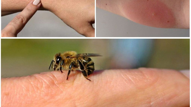 IMSP CNAMUP atenționează: Crește numărul de reacții alergice grave la înțepături de insecte
