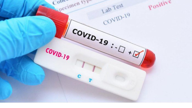 Peste 600 de cazuri de infectare cu COVID-19 au fost înregistrate în ultima săptămână
