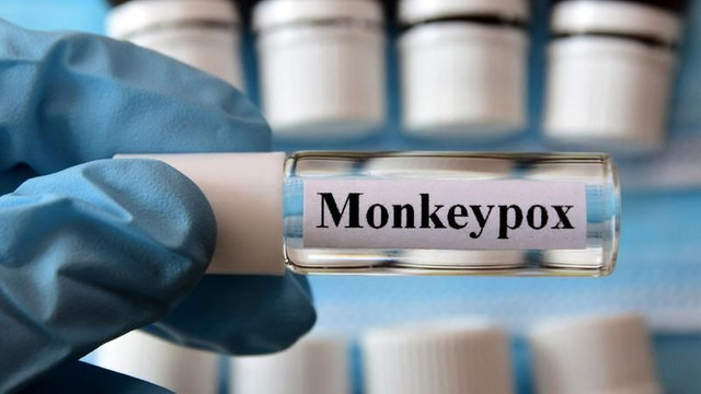 Un nou caz de variola maimuței, confirmat în România