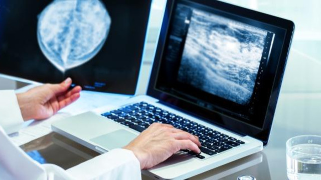 Investigațiile efectuale la mamografele din Chișinău și Bălți vor fi conectate printr-un sistem digital
