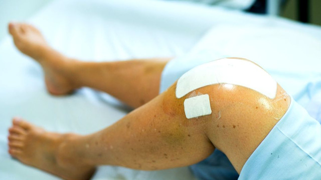 Crește numărul beneficiarilor de operații de protezare a genunchiului și șoldului