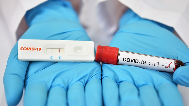 Ministerul Sănătății anunță o descreștere a numărului de îmbolnăviri cu COVID-19 în R. Moldova