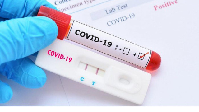 Peste 160 de cazuri de infectare cu COVID-19 s-au înregistrat în ultima săptămână
