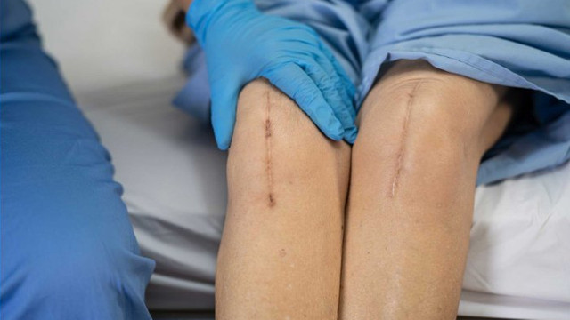 Peste cinci mii de pacienți din Republica Moldova au beneficiat anul trecut de operații de protezare a genunchiului și șoldului