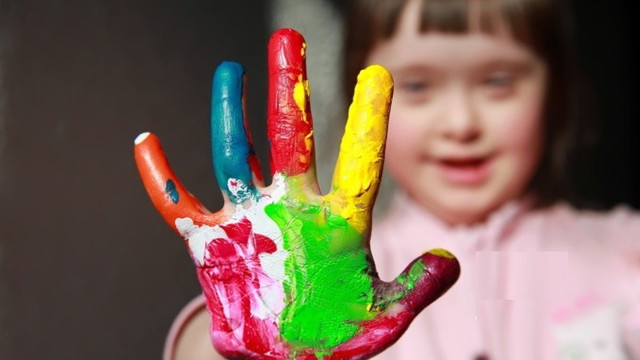 Astăzi, 21 martie, este marcată Ziua Mondială a Sindromului Down