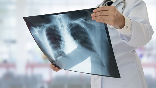 Noi cazuri de tuberculoză confirmate în Chișinău. Autoritățile monitorizează situația
Noi cazuri de tuberculoză confirmate în Chișinău. Autoritățile monitorizează situația
